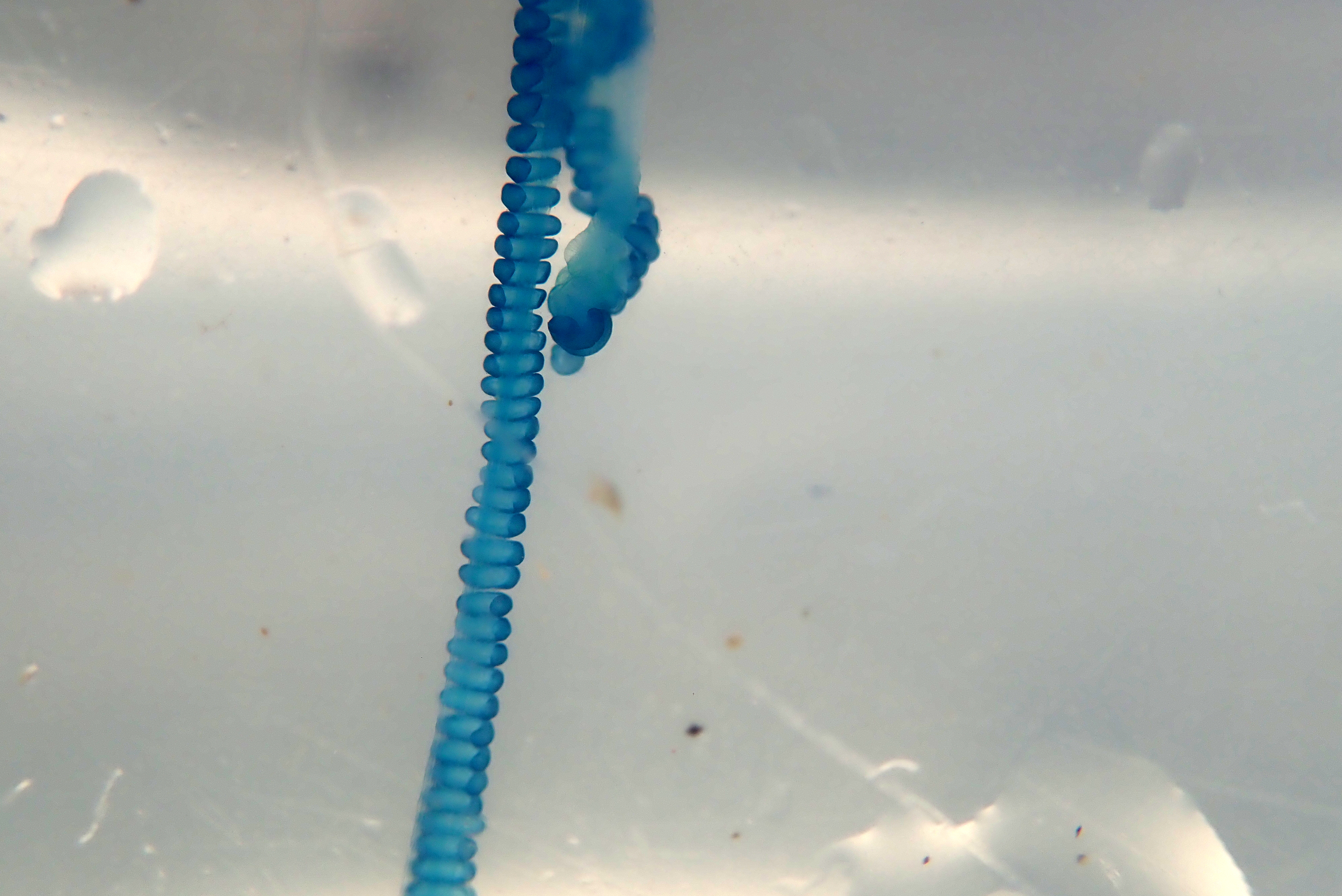 A stinging tentacle of the Portuguese man o'war